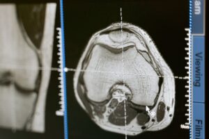 Mri breakthrough — MRI Breakthrough Reveals 2026: Faster Scans