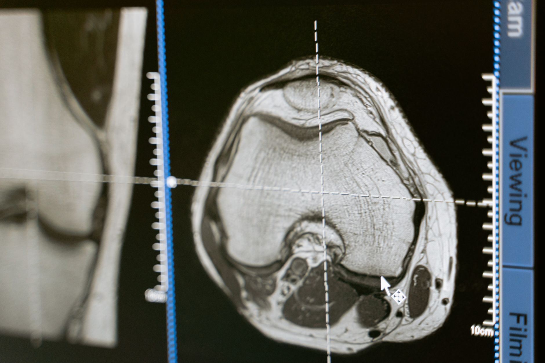 Mri breakthrough — MRI Breakthrough Reveals 2026: Faster Scans