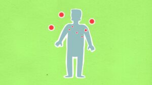 Cyclospora outbreak — Cyclospora Outbreak Warns 400