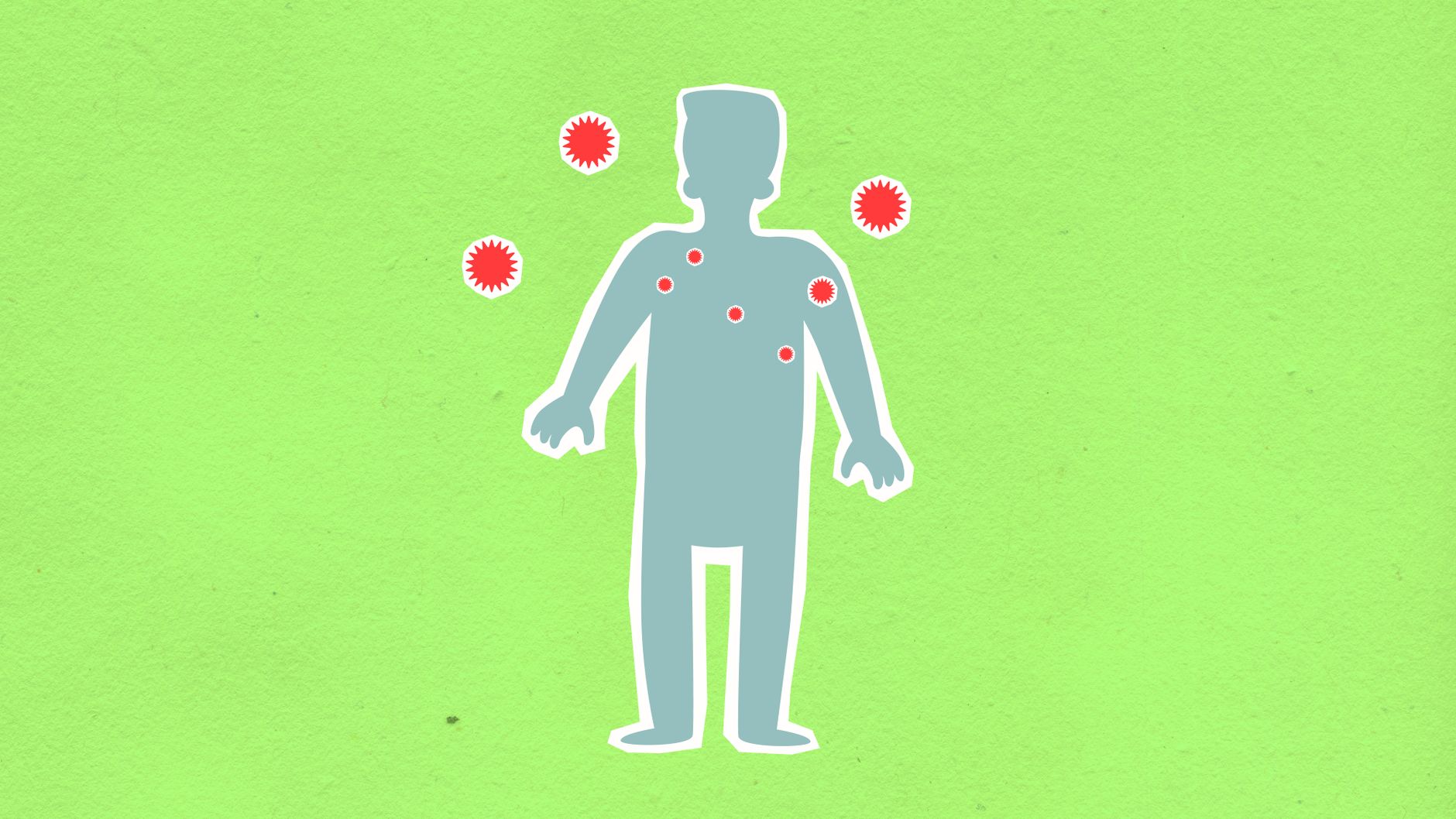 Cyclospora outbreak — Cyclospora Outbreak Warns 400