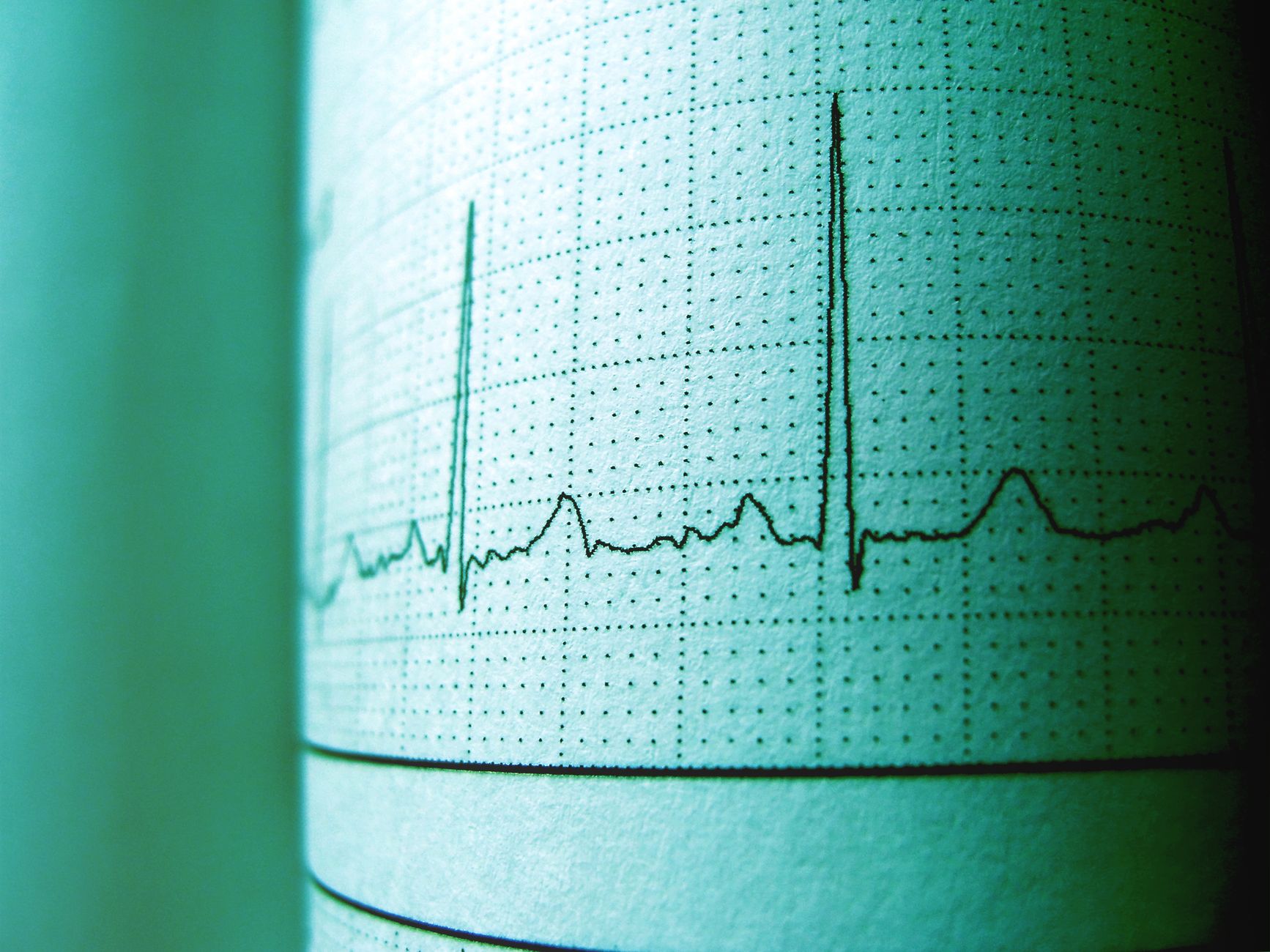 Heart disease prediction — Heart Disease Prediction Reveals 15 Year Warning