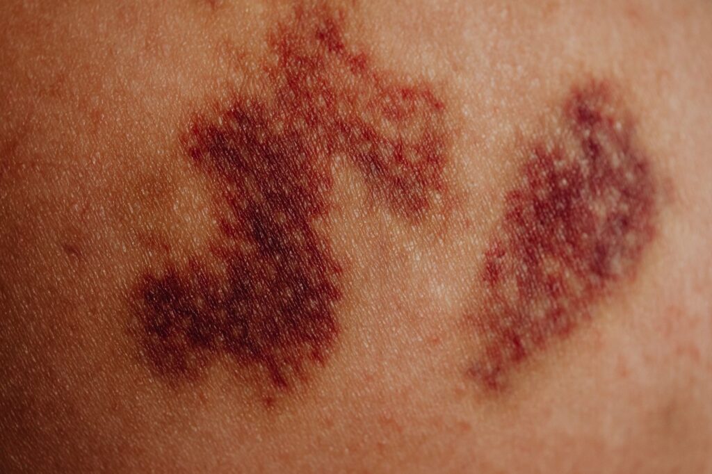 Skin damage — Skin Damage Reveals 3 Key Signs