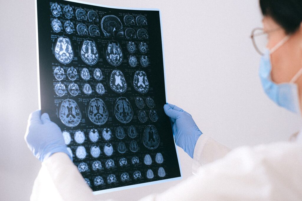 Alzheimer's treatments — Alzheimer's 2026 Breaks: New Hope