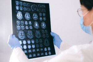 Alzheimer's treatments — Alzheimer's 2026 Breaks: New Hope
