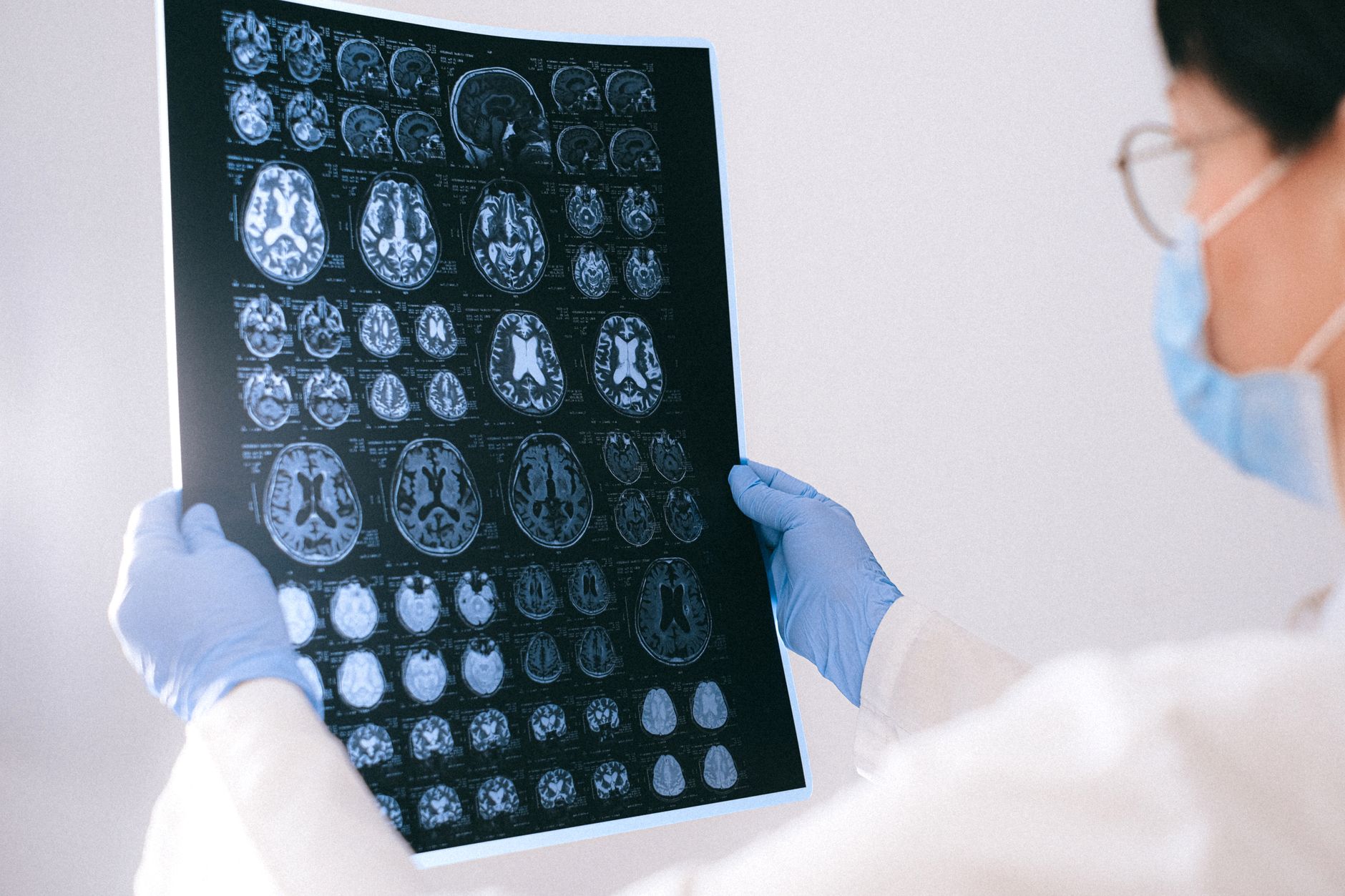 Alzheimer's treatments — Alzheimer's 2026 Breaks: New Hope