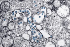 Pathogenic review — Pathogenic Review Breaks: 2026