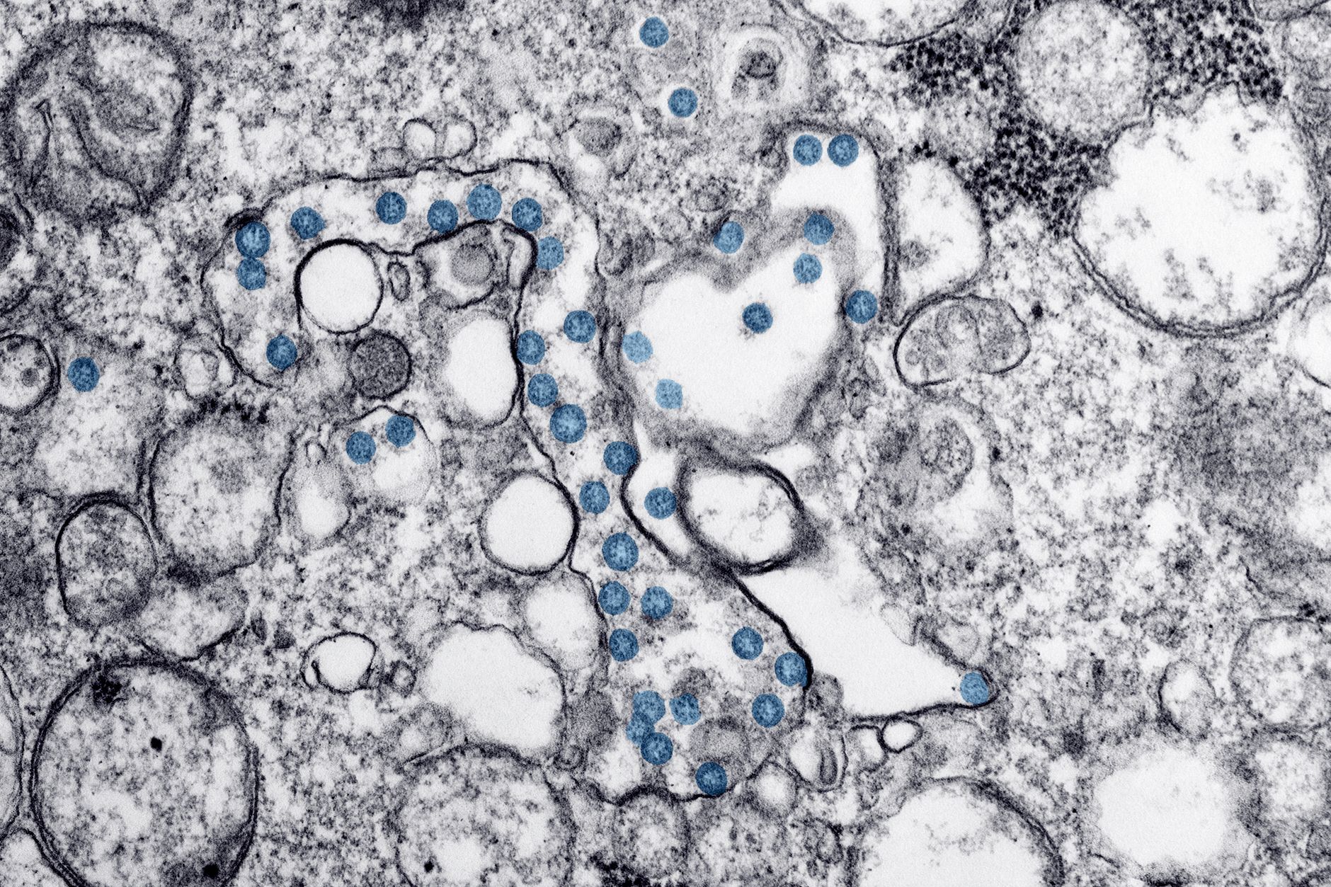 Pathogenic review — Pathogenic Review Breaks: 2026