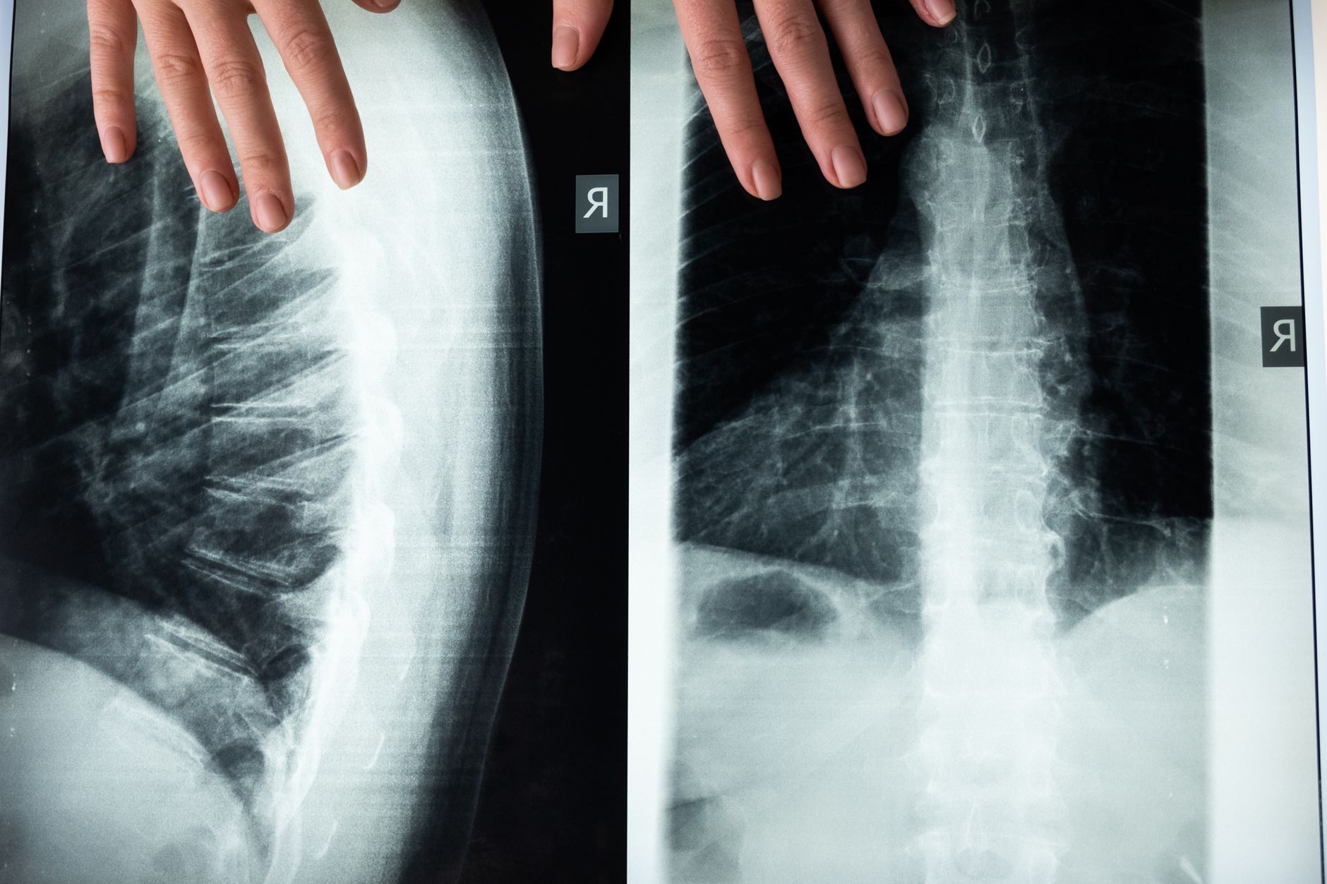 Ultrafast x-rays — Ultrafast X-rays Reveals 2026 Breakthrough