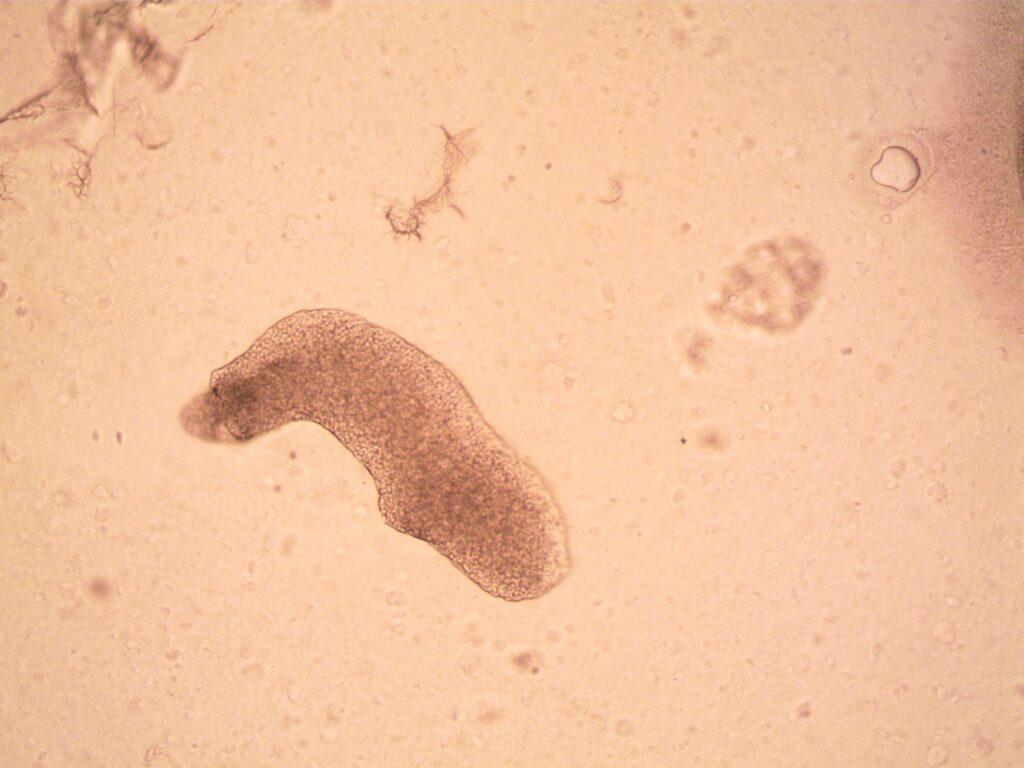 Brain destroying amoeba — Brain Destroying Amoeba Hits 1: Reveals Fatal Infection