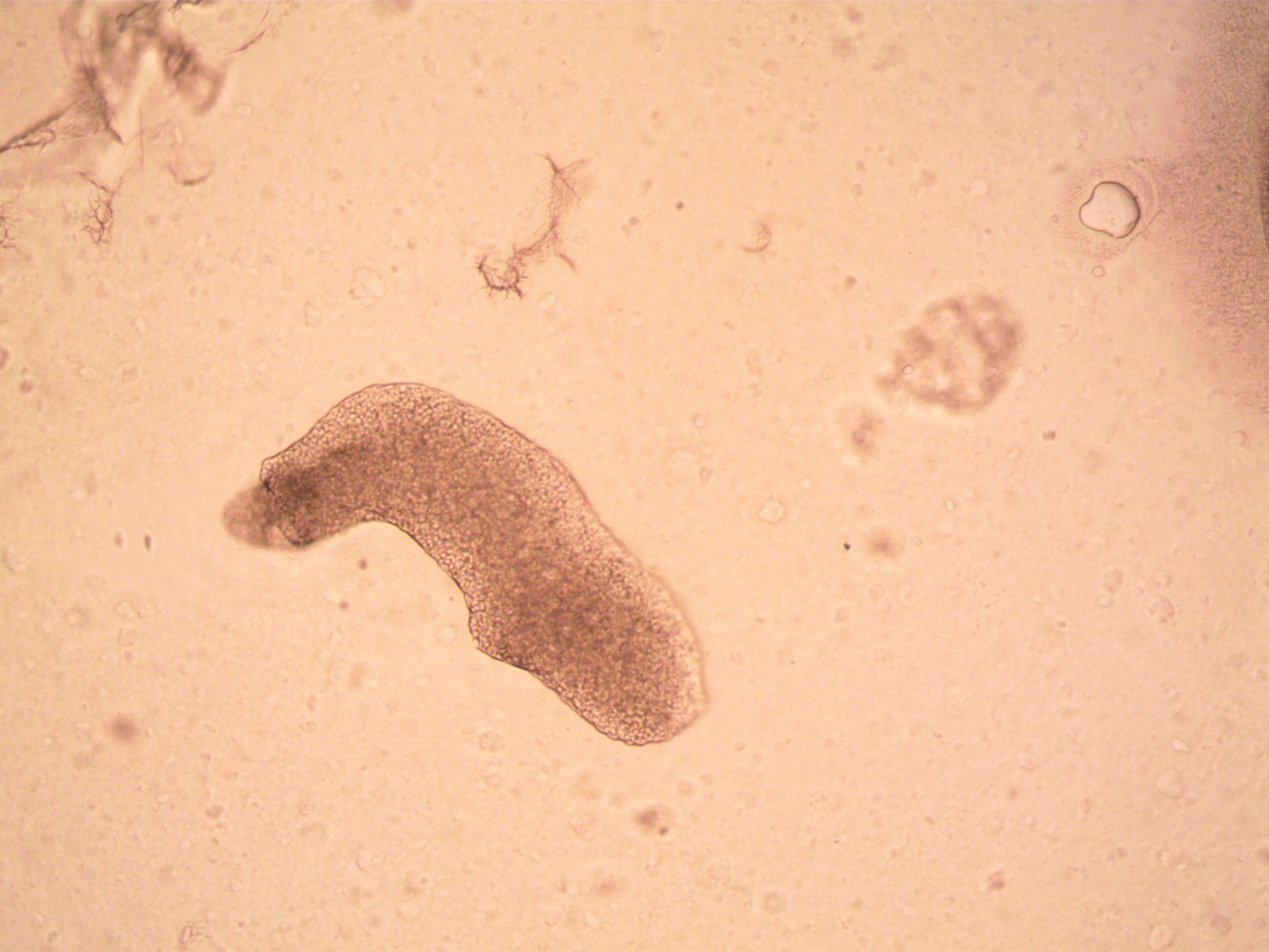 Brain destroying amoeba — Brain Destroying Amoeba Hits 1: Reveals Fatal Infection