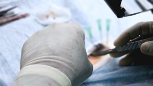 Organ transplants — Organ Transplants 2024: NHS Faces Criticism