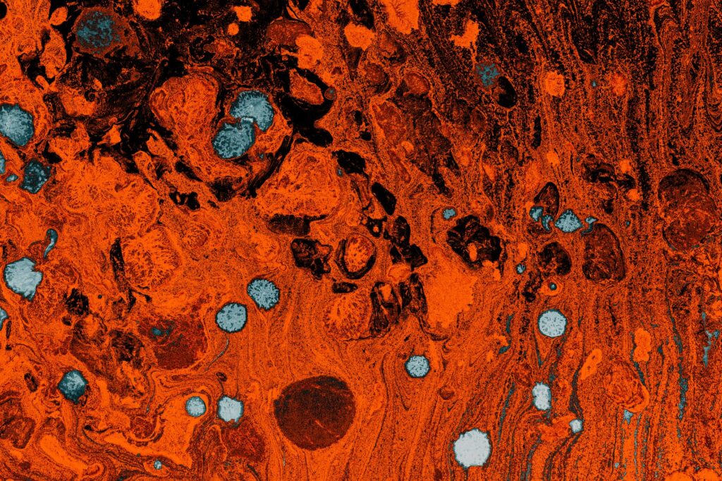Syphilis origins — Syphilis Origins 3,500 Years Old: Breaks Mystery