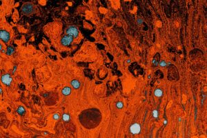 Syphilis origins — Syphilis Origins 3,500 Years Old: Breaks Mystery